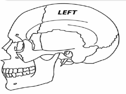 3D Craniofacial Custom Implant CAD Modeling